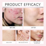 EELHOE Reinigungspads mit Kojisäure und Kurkuma – Beauty