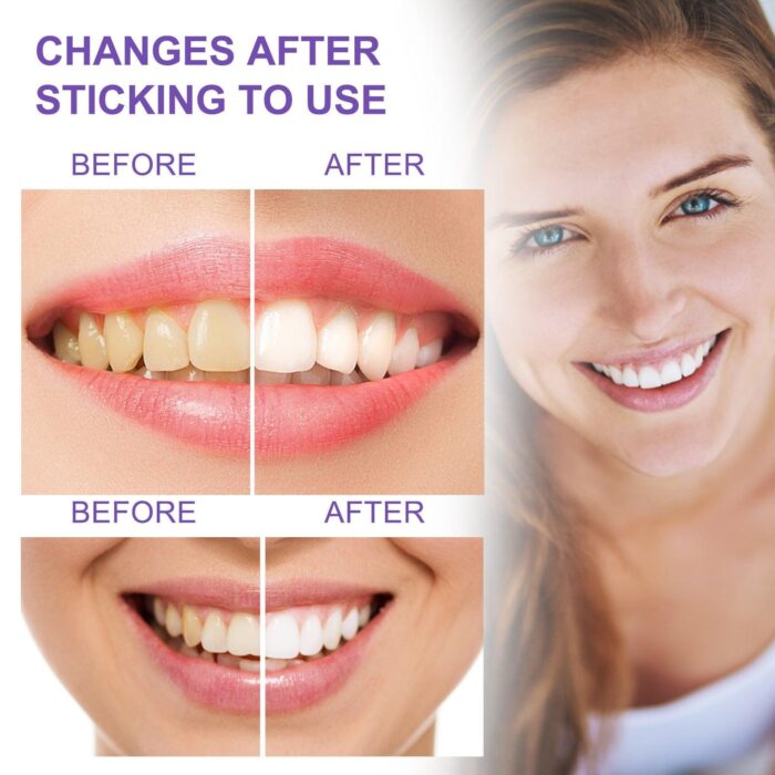 EELHOE Whitening Zahnpasta V34