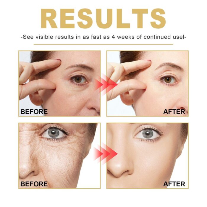 EELHOE Anti-Falten-Gesichtsserum, Lifting, Straffung, Verblassen feiner Linien, Anti-Aging-Essenz